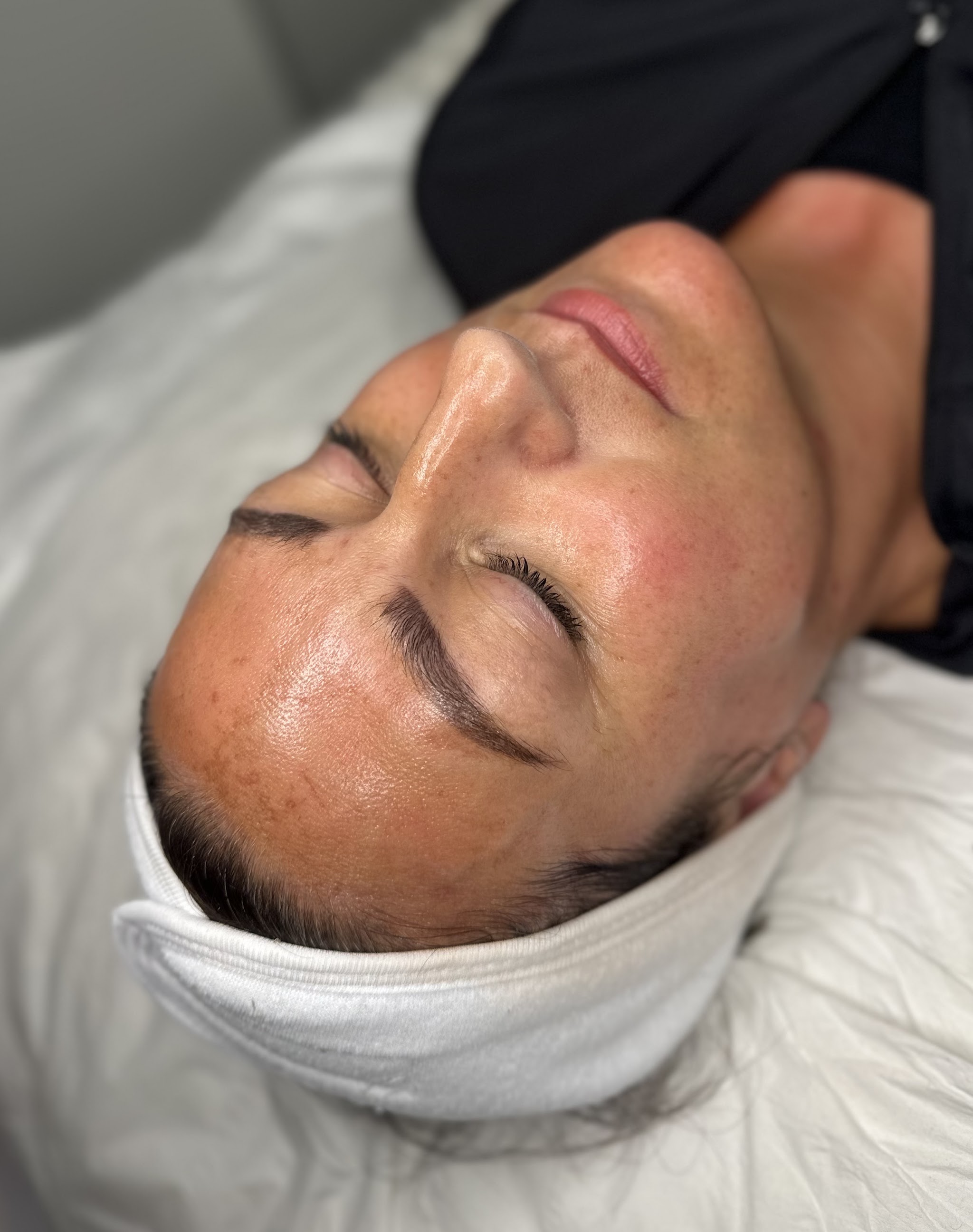 A client wearing a soft headband after a HydroFacial