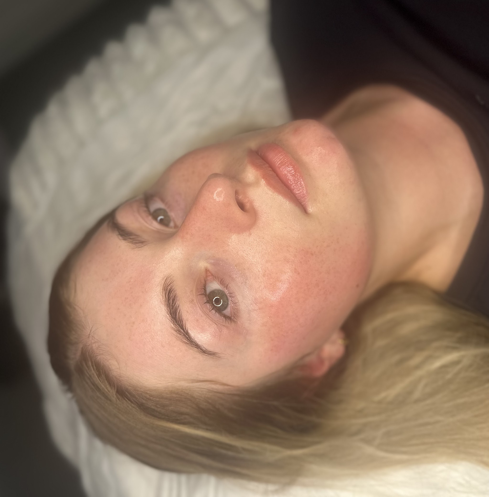 A client with bright, even skin after a peel