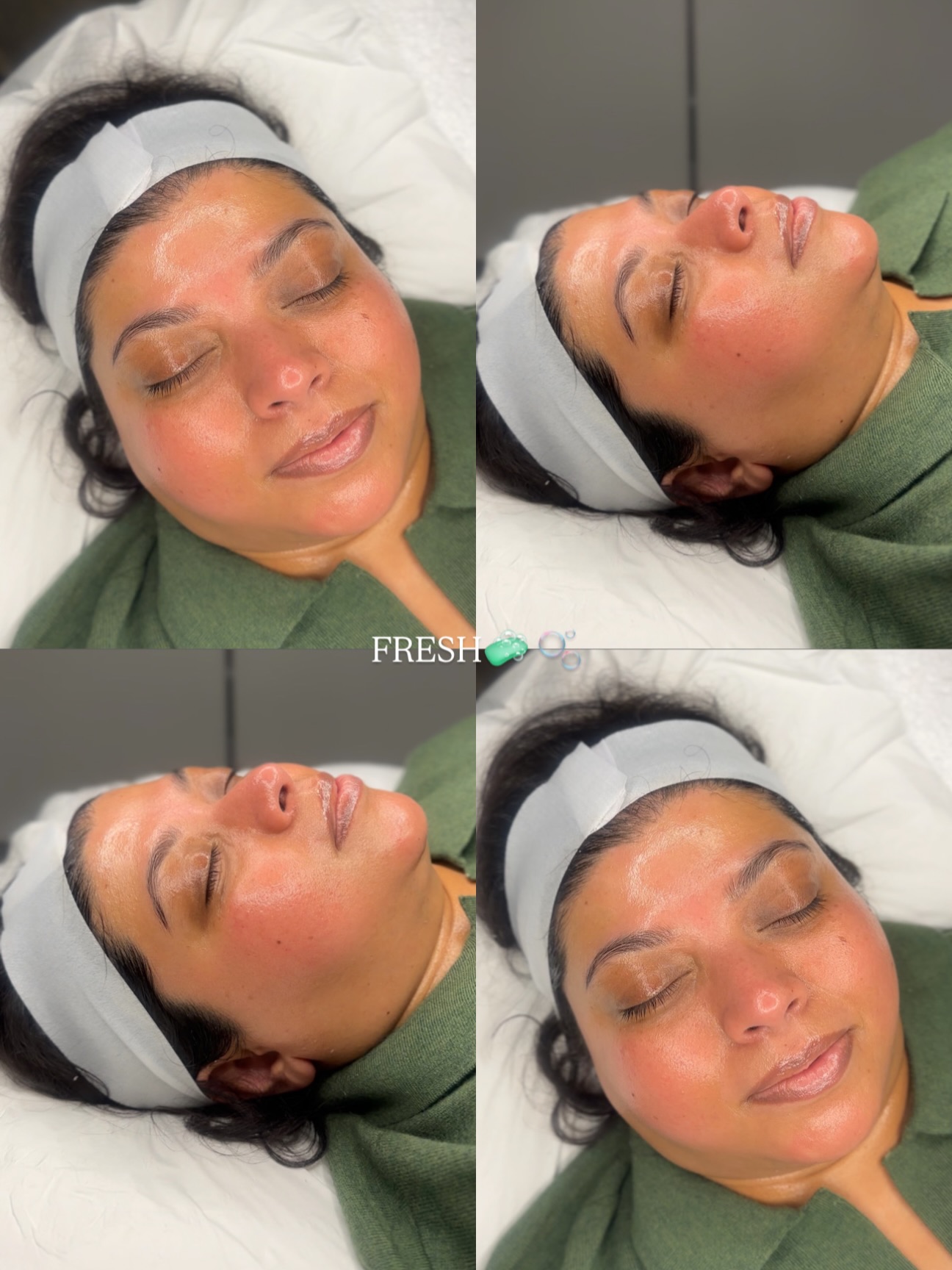 A client during and after a glow facial, four photos