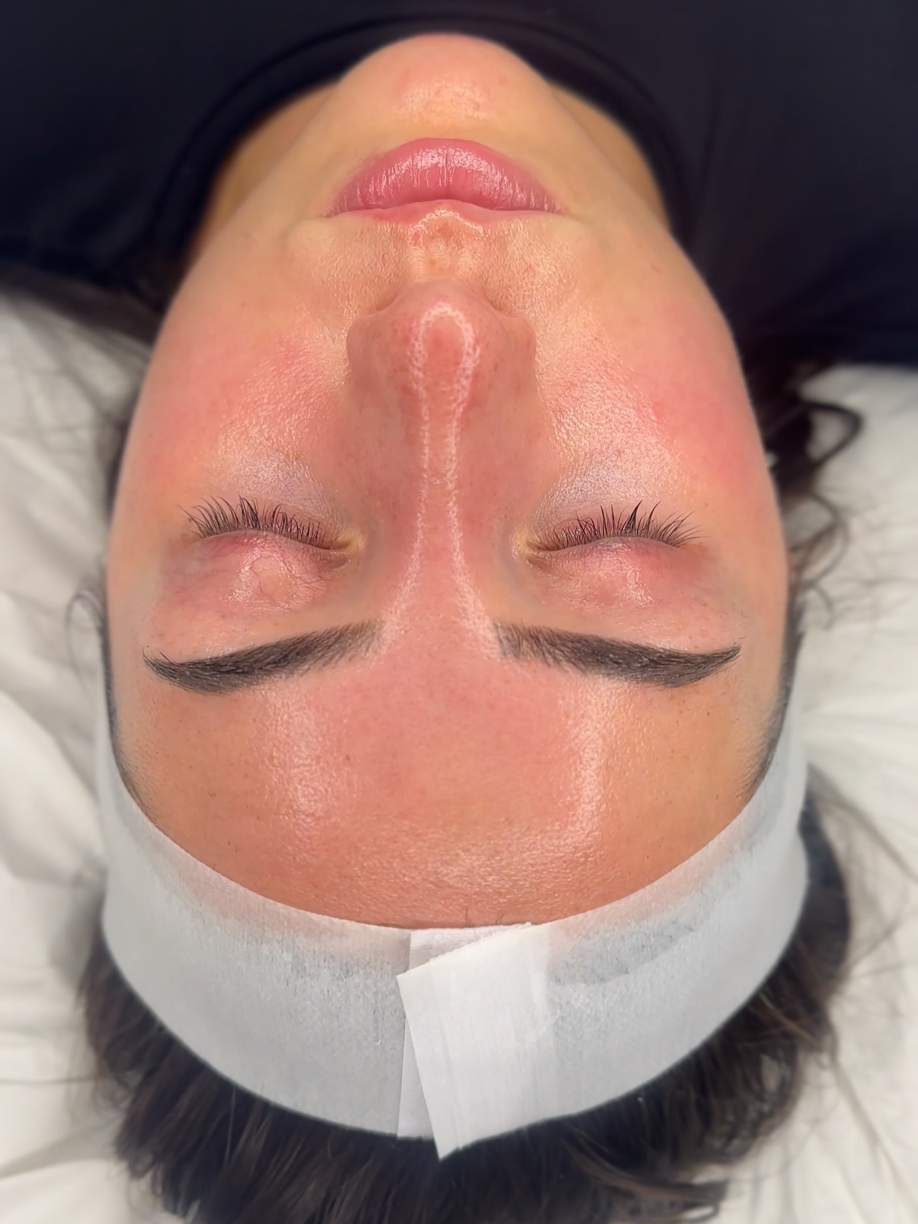 Calm, even skin after a facial